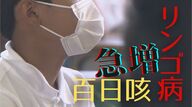 【急増】百日咳とリンゴ病　“風邪のような初期症状”で強い感染力　ワクチン免疫切れの小学生は要注意　熱がなくてもマスクを