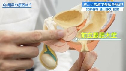 「前立腺肥大症」は男性の頻尿原因…「前立腺がん」の治療法“ダヴィンチ”を泌尿器科の医師が解説