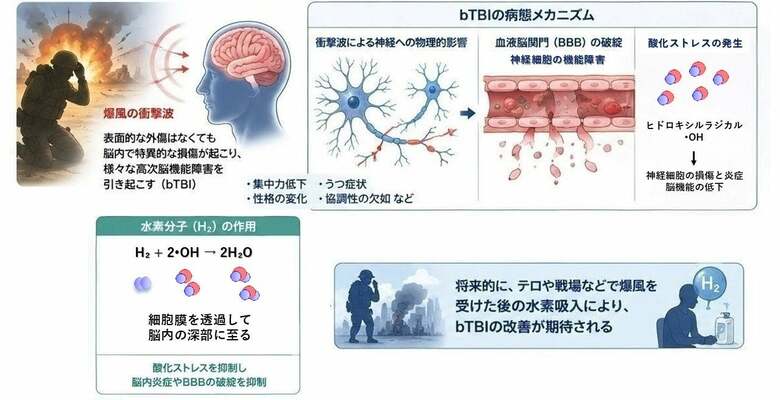 低濃度水素吸入が爆風由来TBIのうつ・社会性障害を抑制｜MiZ・防衛医科大学校 共同研究