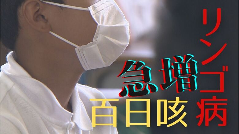 【急増】百日咳とリンゴ病　“風邪のような初期症状”で強い感染力　ワクチン免疫切れの小学生は要注意　熱がなくてもマスクを｜FNNプライムオンライン