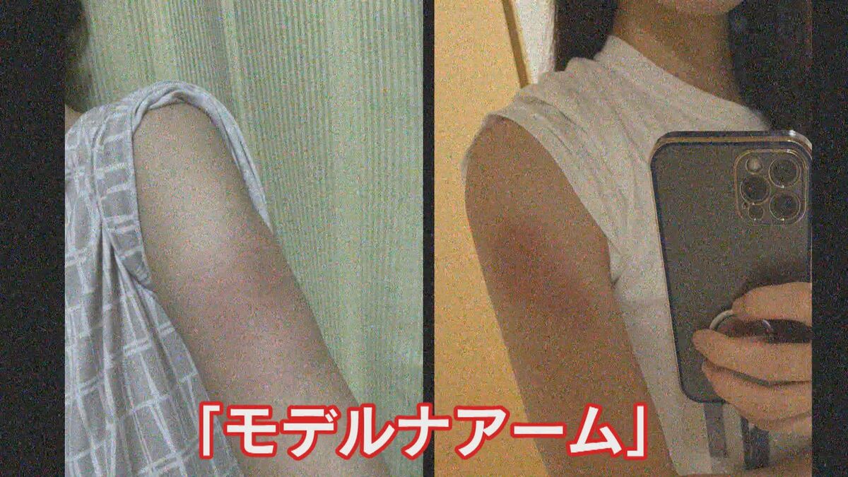 腕にかゆみや赤み 副反応 モデルナアーム の実態と対処法 医師 恐れる必要ない 福岡発