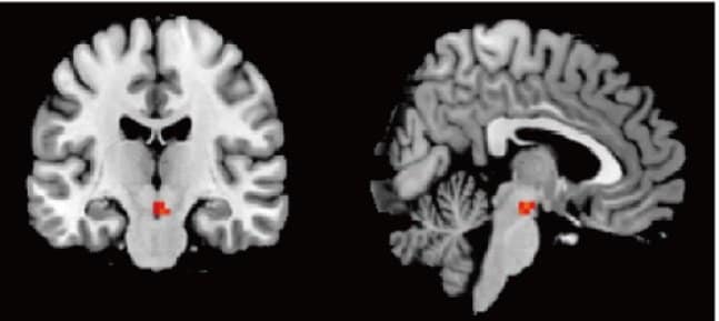 自分の顔に対して強く活動した脳の場所（大阪大学HP）