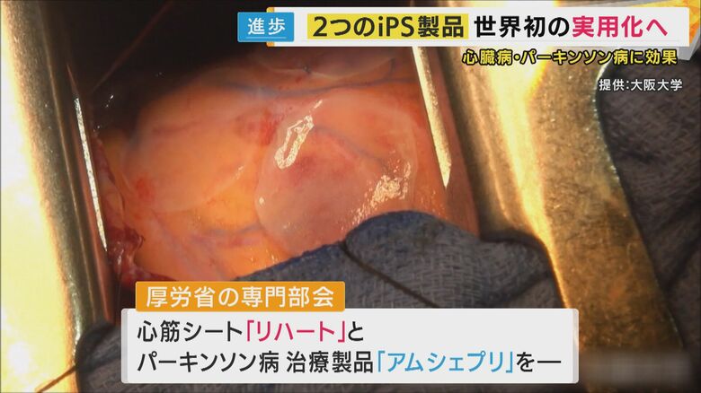 心臓病の治療に実用化