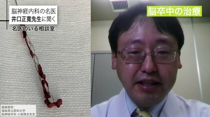 『脳卒中』一番の危険因子は高血圧…早期発見のための予兆「BE FAST」とは? 専門医が予防法解説