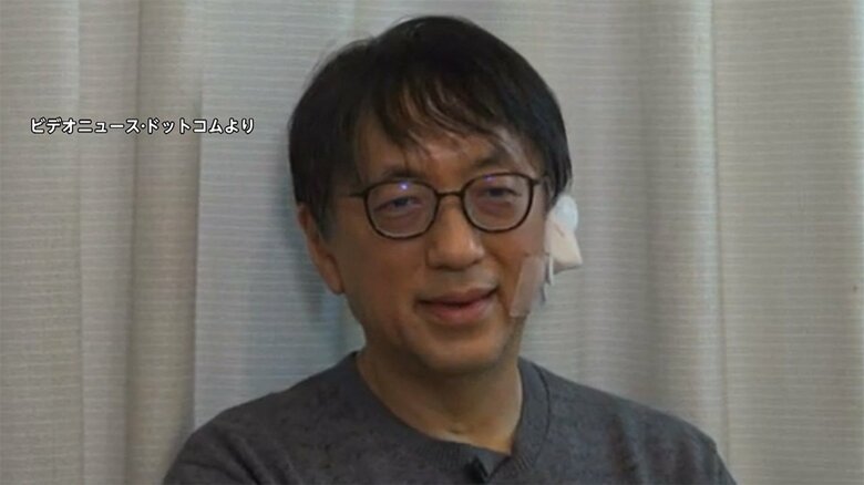 退院後、事件について語る宮台真司さん