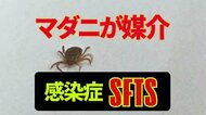 マダニ媒介の感染症「SFTS」福井県内でも3年ぶりに感染確認　農作業中の80代女性　草むらでは肌の露出避ける対策を