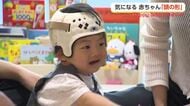 赤ちゃんの頭の形が気になったら…「ヘルメット治療」で後頭部が丸く　富山に専門外来