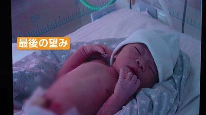 「はじめまして、ママだよ」涙の初対面　代理出産を選んだ日本人夫婦と、「報酬450万円」で命をかけるジョージア人“代理母”の本音【スポットライト】