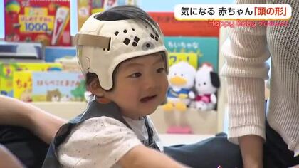 赤ちゃんの頭の形が気になったら…「ヘルメット治療」で後頭部が丸く　富山に専門外来