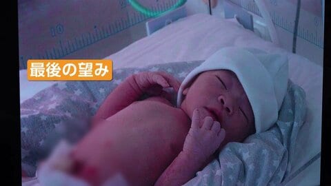 「はじめまして、ママだよ」涙の初対面　代理出産を選んだ日本人夫婦と、「報酬450万円」で命をかけるジョージア人“代理母”の本音【スポットライト】