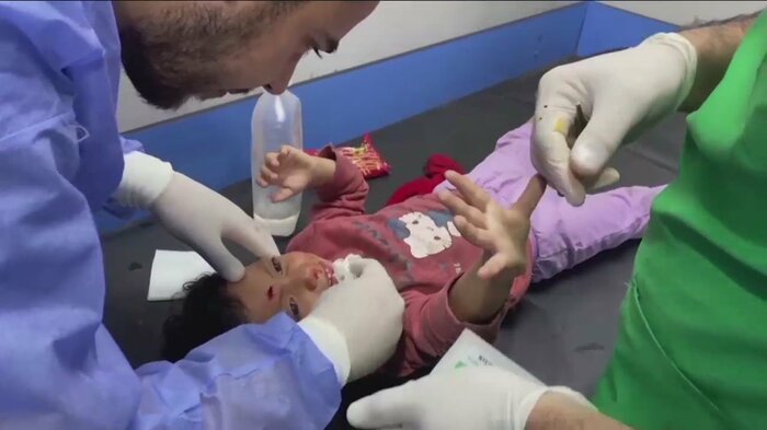 ガザの病院で治療を受ける子ども