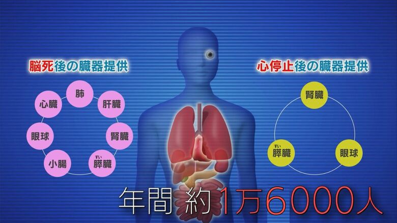 年間1万6000人の人が移植を待つ