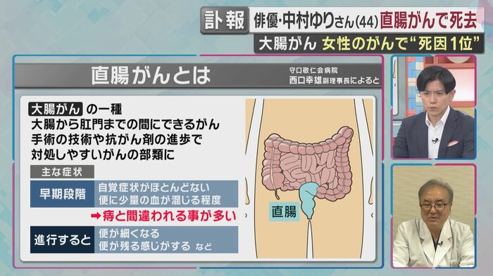直腸がんとは