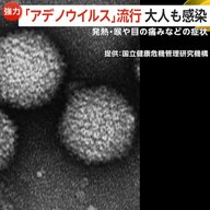 「百日咳患者」子供中心に過去最多更新する一方、大人にも強い感染力「アデノウイルス」流行に要注意…アルコール消毒効きにくく特効薬なし風呂で感染も