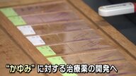 “アトピーのかゆみ” 原因の一つを突き止めた！治療薬開発へ高まる期待【佐賀発】
