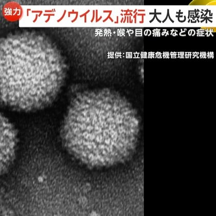 「百日咳患者」子供中心に過去最多更新する一方、大人にも強い感染力「アデノウイルス」流行に要注意…アルコール消毒効きにくく特効薬なし風呂で感染も
