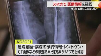 県内初・「いつでも」「どこでも」スマートフォンで自分の医療情報を手軽に確認できる　山形・白鷹町