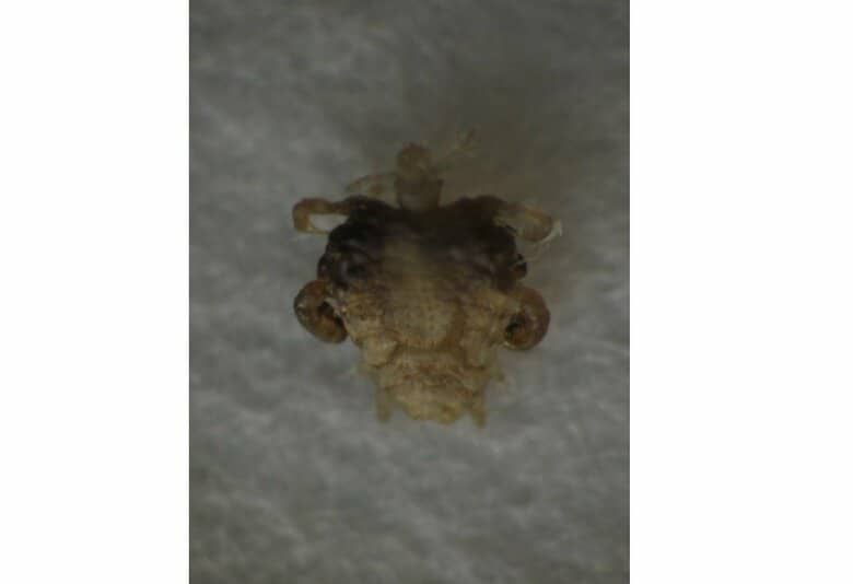 ケジラミ（画像提供：東京都保健医療局）