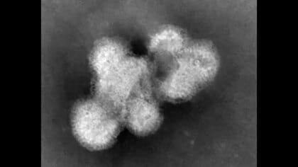 12週連続の警報レベルで学級閉鎖や学年閉鎖相次ぐ　インフルエンザＢ型が増加傾向　