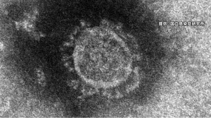 長野県内で初の『院内感染』か　軽井沢の医療機関で患者3人陽性　病院「行動歴に申告漏れあった」