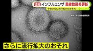 インフルエンザB型が静岡県内で猛威　患者数は今シーズン最多を更新…今後さらに感染拡大のおそれ