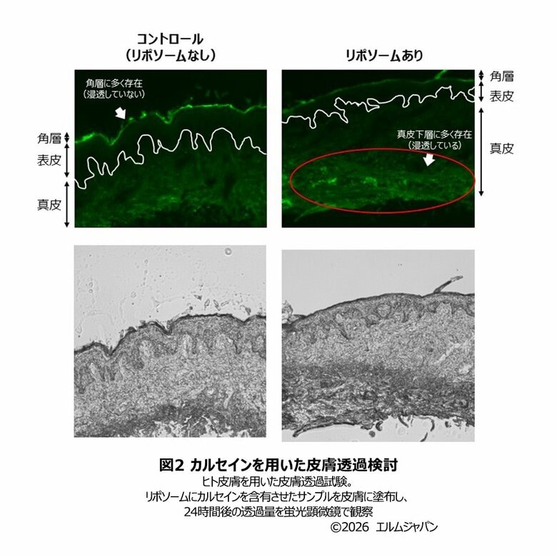 多重層リポソームを基盤とした経皮吸収技術の開発
