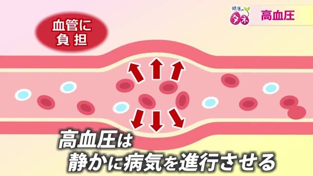 サイレントキラーと呼ばれる高血圧