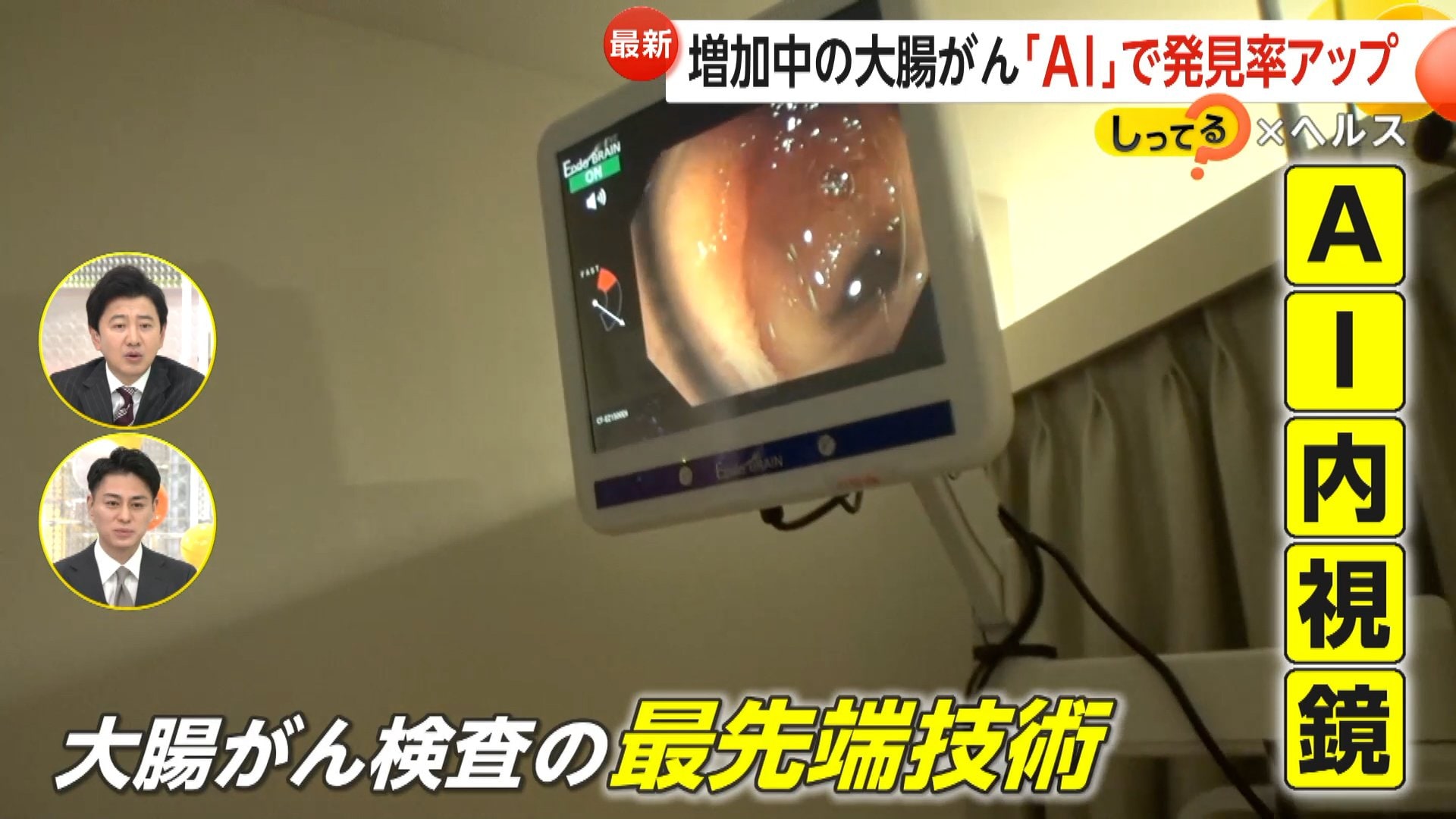 女子高生　肛門検査 がん発見率が“7〜10％向上”…増加中の大腸がん発見する「内視鏡AI」 40歳から内視鏡検査を推奨…検査 費は保険適用に【しってる？】（FNNプライムオンライン）｜ｄメニューニュース（NTTドコモ）