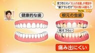 気づきにくい「大人の虫歯」“歯ブラシだけ”汚れ残り4割　歯科医が伝授する持ち方やすすぎ方、ブラシの選び方も