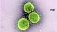新型コロナ 東京都で新たに1070人の感染確認 重症者は156人