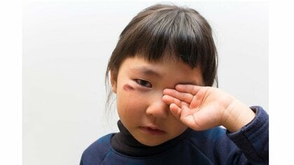 重篤化する児童虐待ケースの早期発見にAIを活用…効果はあった？実証実験を行った練馬区に聞いた