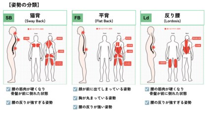 会社員の姿勢で最も多いのは、猫背?理学療法士が、働く人たちの姿勢を3つのタイプで分類