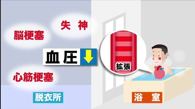 血圧の急変化が要因に