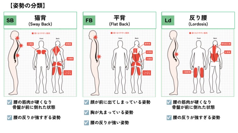 会社員の姿勢で最も多いのは、猫背?理学療法士が、働く人たちの姿勢を3つのタイプで分類