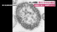 静岡県内で今年初の“はしか”感染を確認　全国的に拡大傾向にあり注意呼びかけ