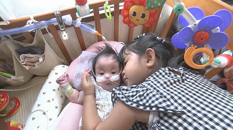 1歳までの生存率5~10%「18トリソミー」1年9か月を懸命に生きた女の子 家族の思いは「目を閉じると大きな愛が蘇ってくる」【大分発】|FNNプライムオンライン