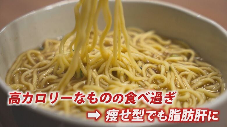 日本人は痩せ型でも15％が脂肪肝！？　アルコールやカロリー“過多”は改善を　ビタミンＥ摂取も効果的　｜FNNプライムオンライン