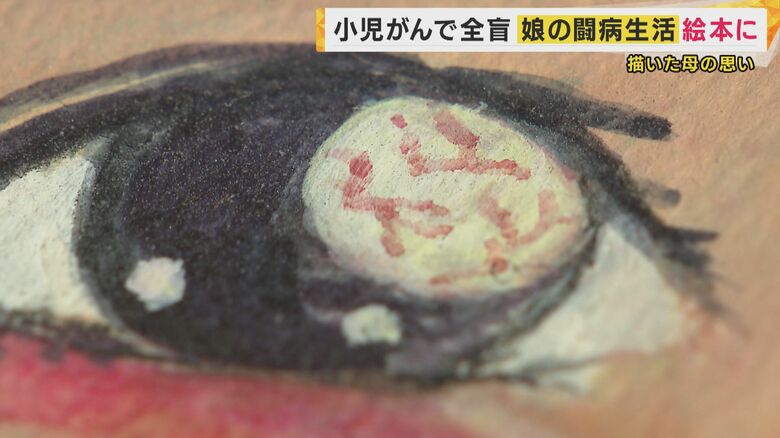 「目の異変」は記憶の通りに