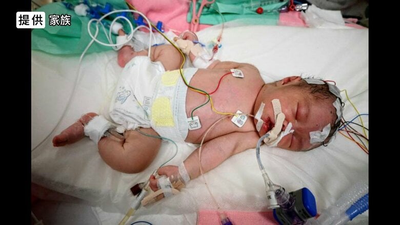 別の病院で入院時（提供：家族）