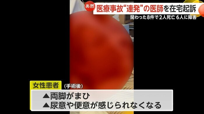 松井被告は神経の一部を誤って切断した