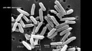旅館で食事を食べた81人が下痢や腹痛などの症状　サルモネラ属菌による食中毒と断定　患者は東京、埼玉、愛知などに住む10歳未満から70代以上　3人が入院