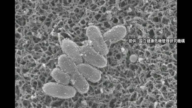 百日咳の感染者が３週連続過去最多の3578人に…今年累計で4万人超で厚労省がワクチン接種・マスク着用呼びかけ｜FNNプライムオンライン