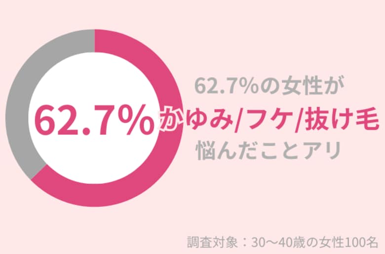62.7%の30代女性が「かゆみ・フケ・抜け毛」に悩んだことあり。シャンプー方法を見直して!