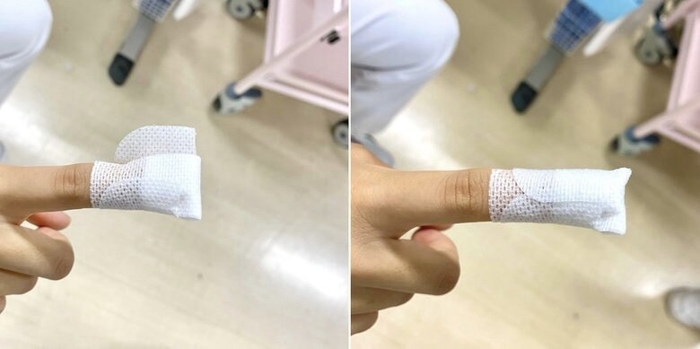 貼り方手順2(提供:湘南鎌倉総合病院)