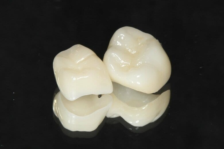 ジルコニアセラミックス（提供：アンチエイジングデンタルクリニック恵比）