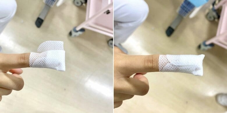 貼り方手順2（提供：湘南鎌倉総合病院）