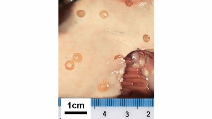 スケトウダラの肝臓に寄生するアニサキスの幼虫(画像提供:国立感染症研究所)