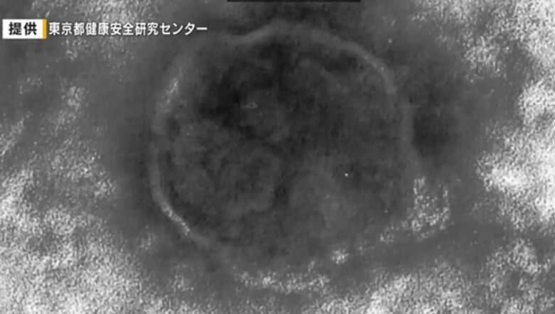 「はしか」感染者を確認　広島県内では６年ぶり　広島市の30代男性　渡航先ベトナムで感染か｜FNNプライムオンライン