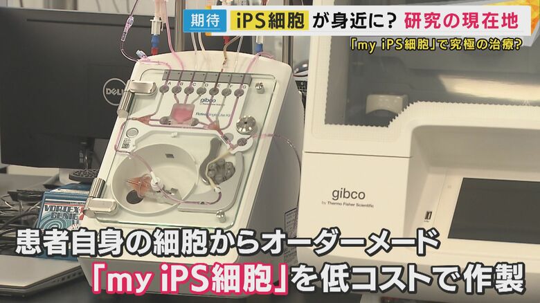 「myiPS細胞」を低コストで作る