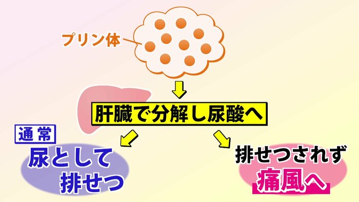 プリン体が上手く排出されないと痛風に